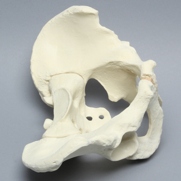Pelvis with Osteoarthritic Acetabulum, Full Male, Solid Foam