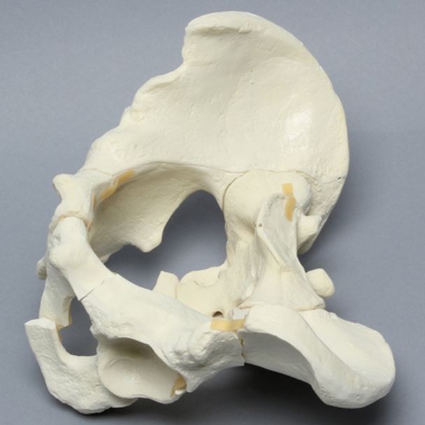 Pelvis with Sacral, Acetabular, and Column Fractures, Full Male, Foam Cortical