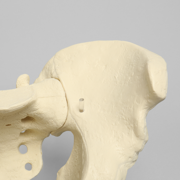 Pelvis, Large, Configured for 1660-12 Base, Solid Foam
