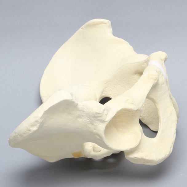 Pelvis with Disruptions, Full Male, Solid Foam
