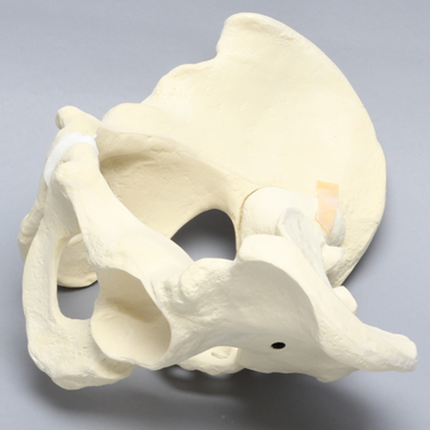 Pelvis with Disruptions, Full Male, Solid Foam