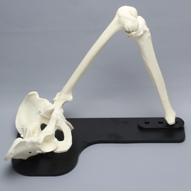 Hip Assembly with Replaceable Knee #1145-38, Male