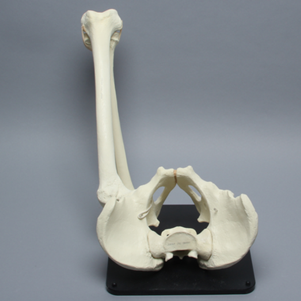 Hip Assembly with Replaceable Knee #1145-60, Male