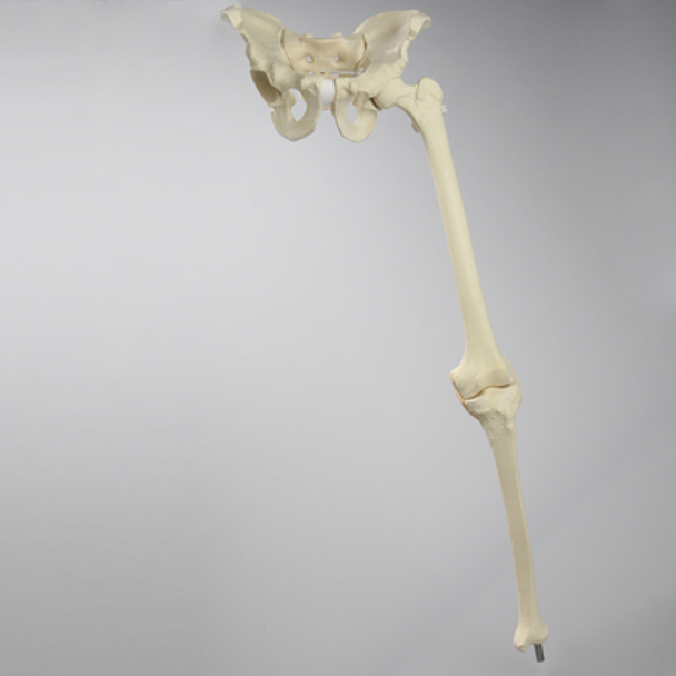 Hip Assembly with Replaceable Knee #1145-33, Male