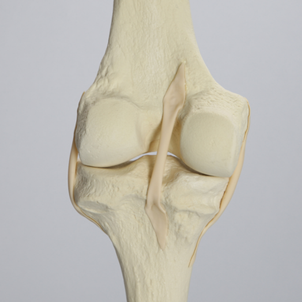 Hip Assembly with Replaceable Knee #1145-33, Male