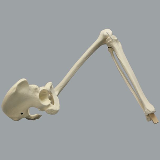 Hip Assembly with Replaceable Knee #1145-33-1, Male