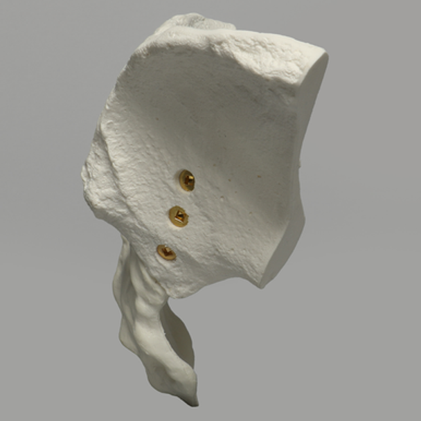 Sacrum with Iliums, Foam Cortical Shell, For Spinal Navigation