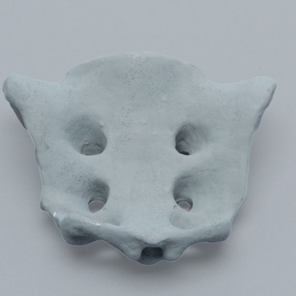 Sacrum, Radiopaque