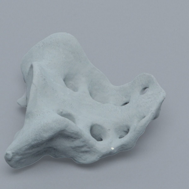 Sacrum, Radiopaque