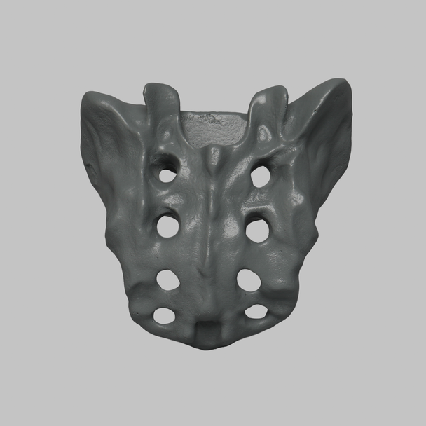 Sacrum, Radiopaque