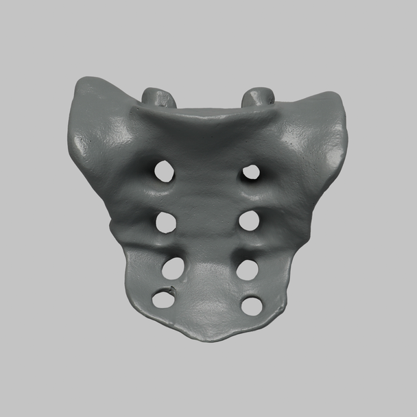 Sacrum, Radiopaque