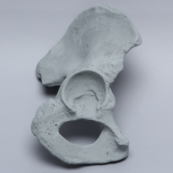 Hemi Pelvis, Male, Radiopaque, Right