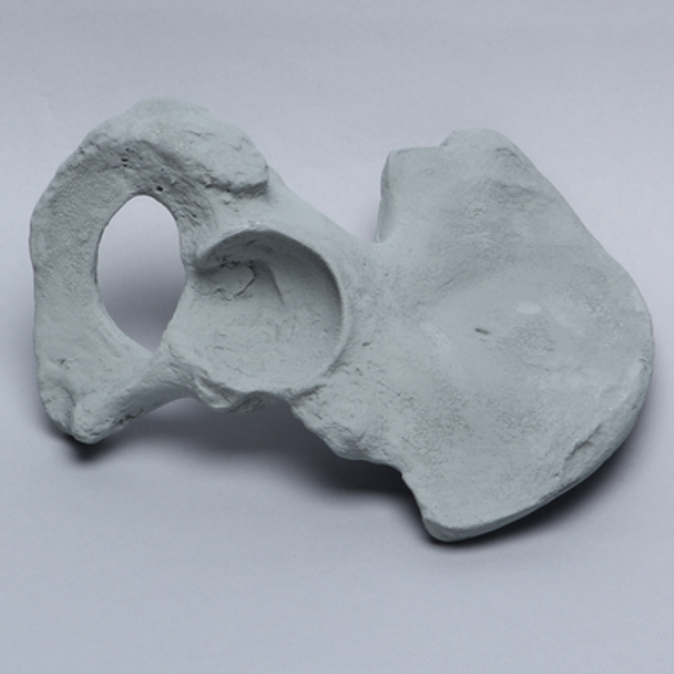Hemi Pelvis, Male, Radiopaque, Right
