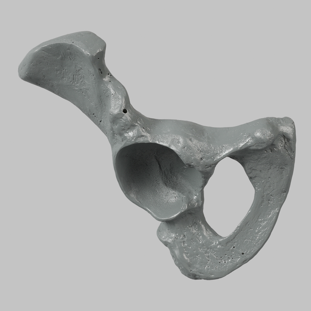 Hemi Pelvis, Male, Radiopaque, Right