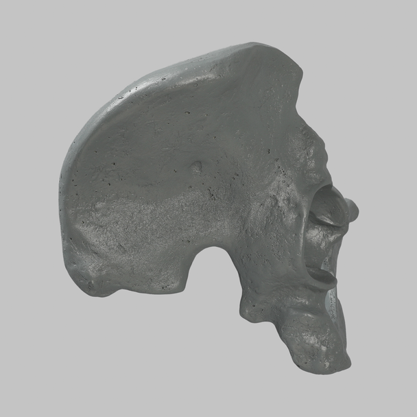 Hemi Pelvis, Male, Radiopaque, Right