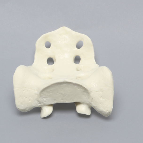 Sacrum, Male, Solid Foam