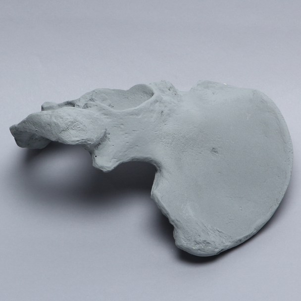 Hemi Pelvis, Radiopaque, Left