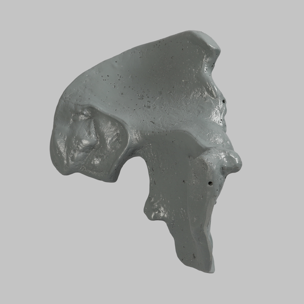 Hemi Pelvis, Radiopaque, Left