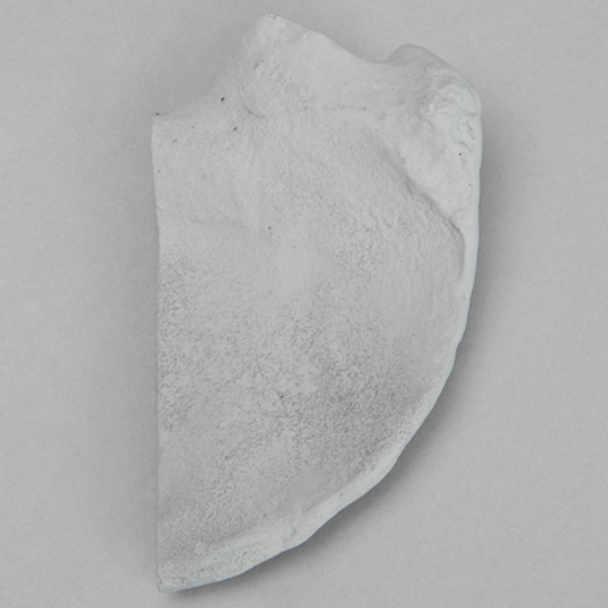 Iliac Crest, Radiopaque, Right