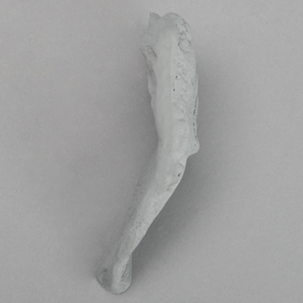 Iliac Crest, Radiopaque, Right