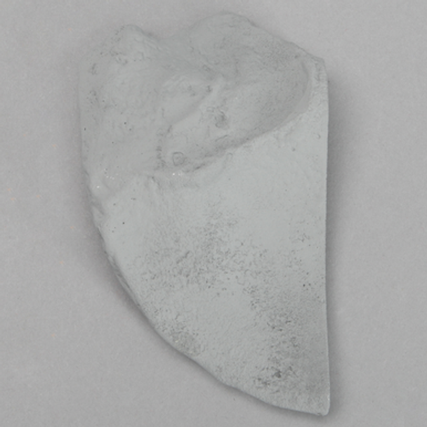 Iliac Crest, Radiopaque, Right
