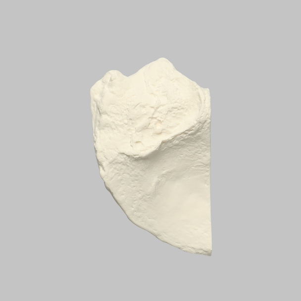 Iliac Crest, Male, Solid Foam, Right
