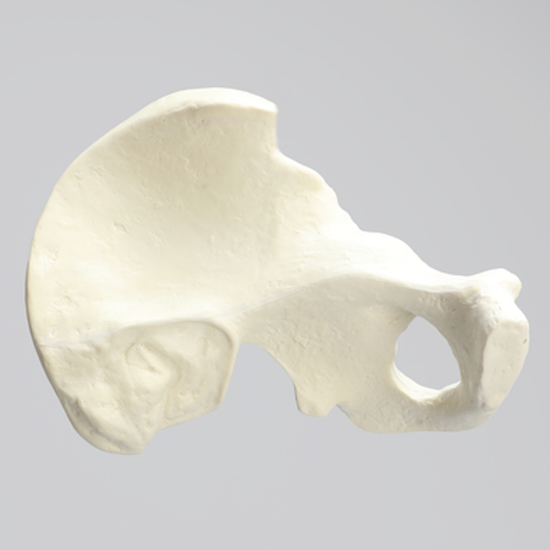 Hemi Pelvis with 57mm Acetabulum, Foam Cortical, Left