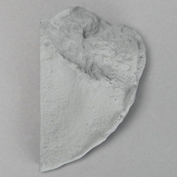 Iliac Crest, Radiopaque, Left