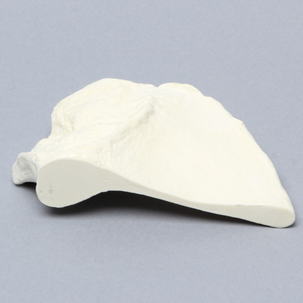 Iliac Crest, Male, Solid Foam, Left
