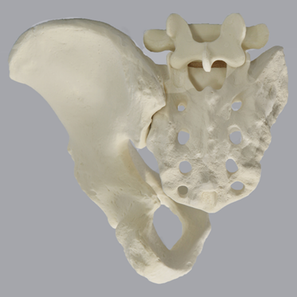 Hemi Pelvis and Sacrum, Solid Foam, Left