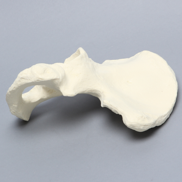 Hemi Pelvis with Osteoarthritis, Solid Foam, Left