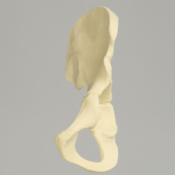 Hemi Pelvis with Defined Ischium and Pubis, Solid Foam