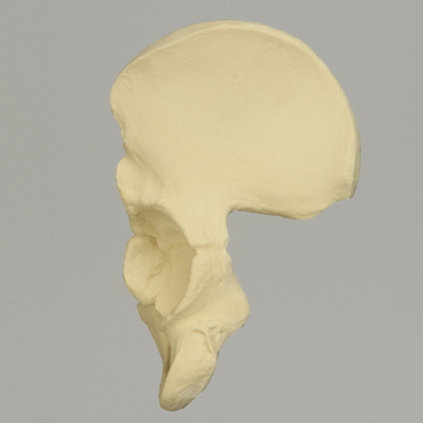 Hemi Pelvis with Defined Ischium and Pubis, Solid Foam