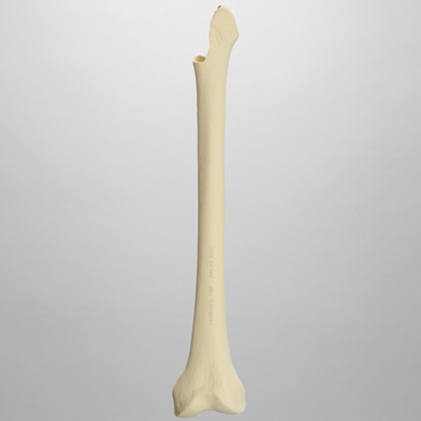 Femur with Proximal Pathologies