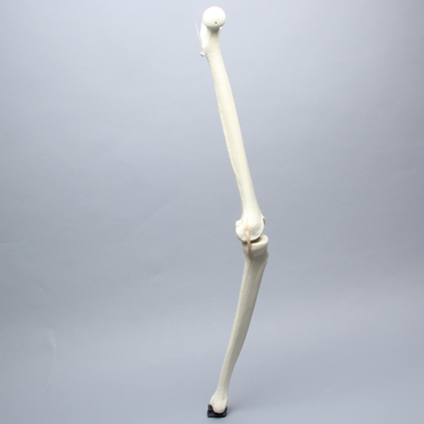 Knee with Three Ligaments