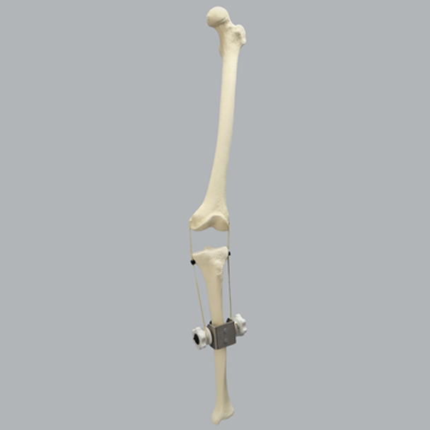 Knee Joint with Adjustable Collateral Ligaments Knee Joint with Adjustable Collateral Ligaments