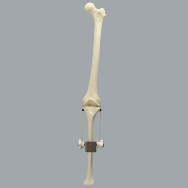 Knee Joint with Adjustable Collateral Ligaments Knee Joint with Adjustable Collateral Ligaments