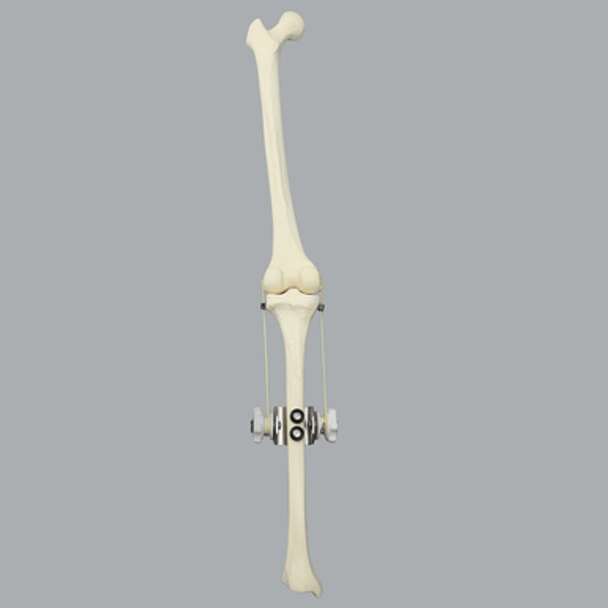Knee Joint with Adjustable Collateral Ligaments Knee Joint with Adjustable Collateral Ligaments