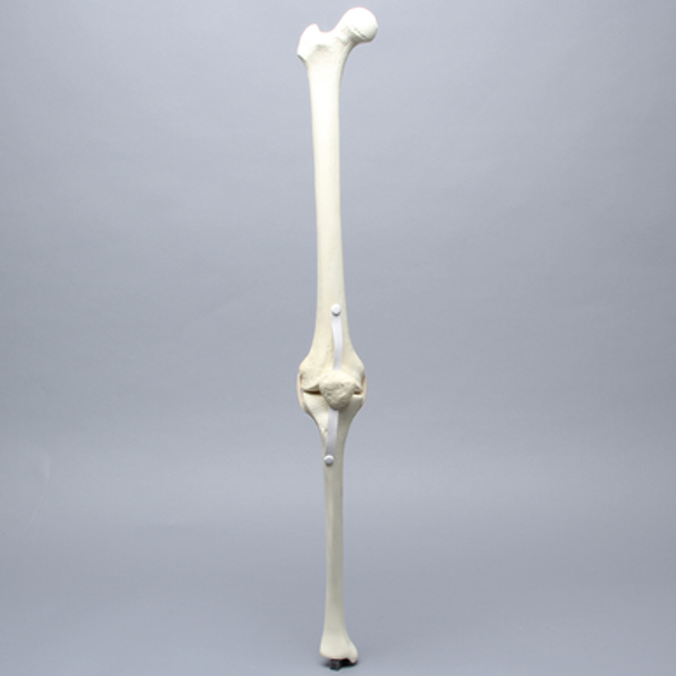 Knee with Patella and Three Stretch Tube Ligaments, Full Length