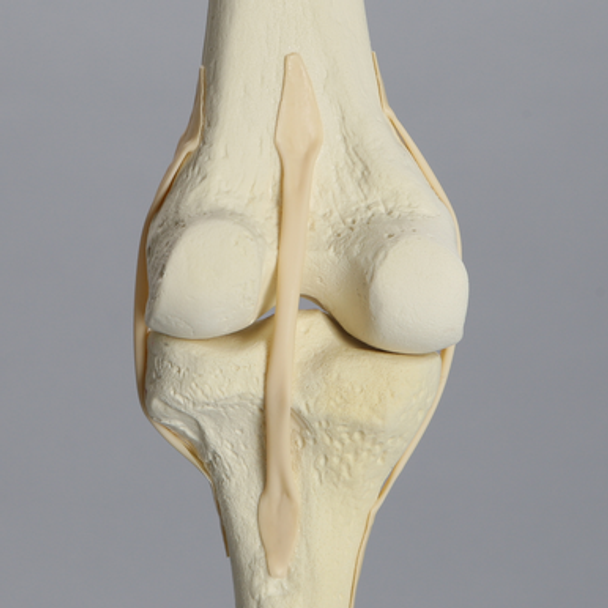 Knee with Three Stretch Cord Ligaments and Light Density Cancellous, Full Length