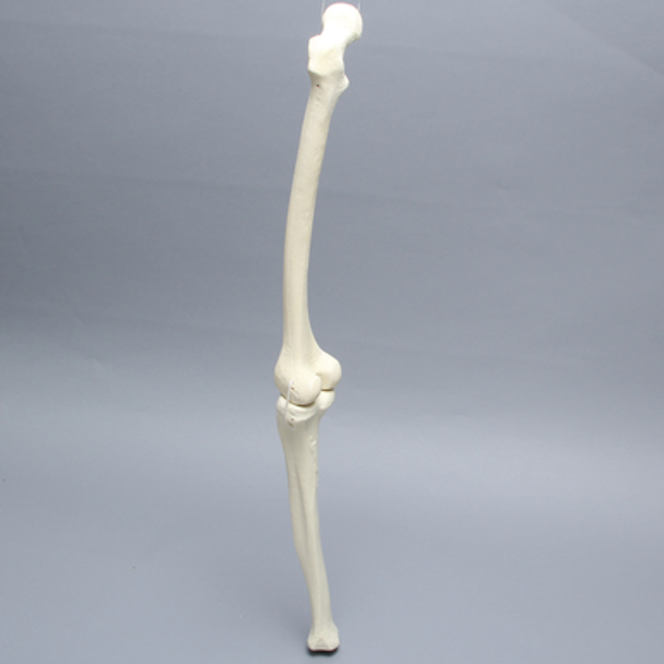 Knee with Two Collateral Ligaments and Narrow Intercondylar Notch, Full Length