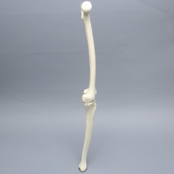 Knee with Two Collateral Ligaments and Narrow Intercondylar Notch, Full Length