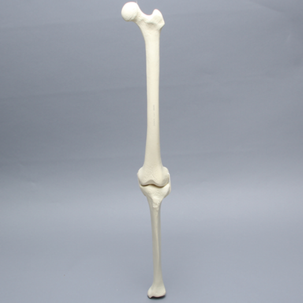 Knee with Two Collateral Ligaments and Narrow Intercondylar Notch, Full Length