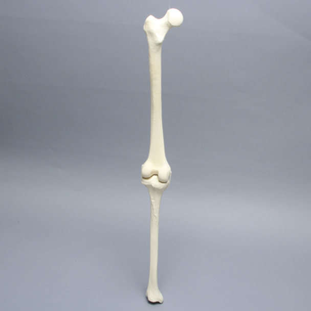 Knee with Two Collateral Ligaments and Narrow Intercondylar Notch, Full Length