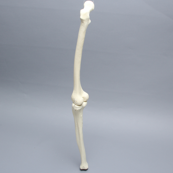 Knee with Two Collateral Ligaments and Narrow Intercondylar Notch, Full Length