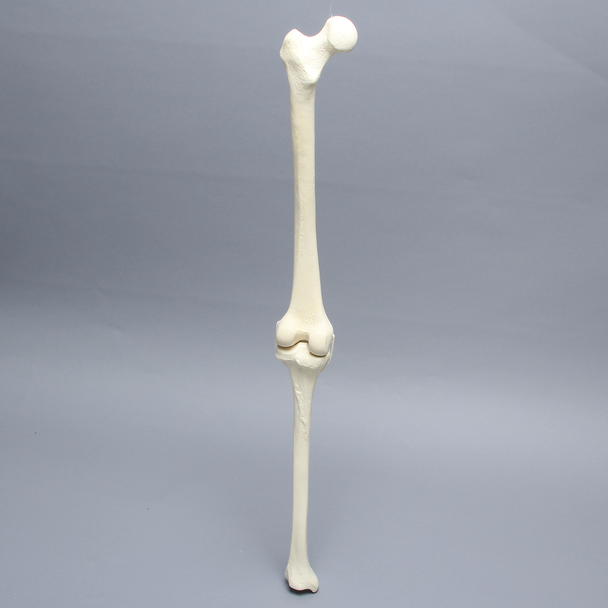 Knee with Two Collateral Ligaments and Narrow Intercondylar Notch, Full Length