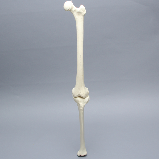 Knee with Two Collateral Ligaments and Narrow Intercondylar Notch, Full Length