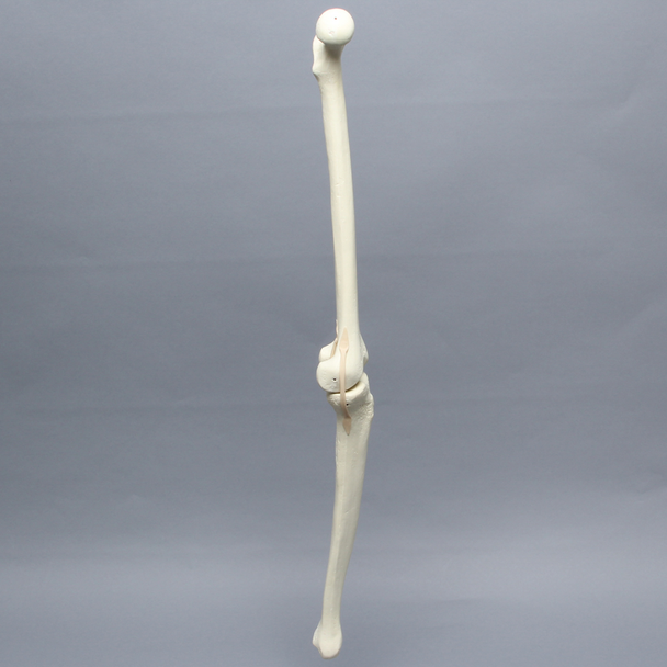 Knee with Narrow Intercondylar Notch and Three Long Stretch Tube Ligaments, Full Length