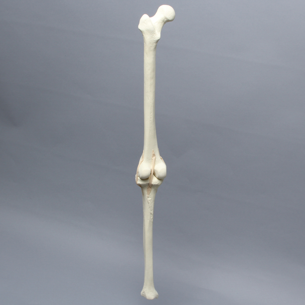 Knee with Narrow Intercondylar Notch and Three Long Stretch Tube Ligaments, Full Length