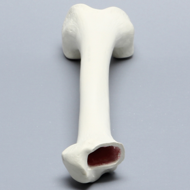 Femur with Broached Proximal Cavity